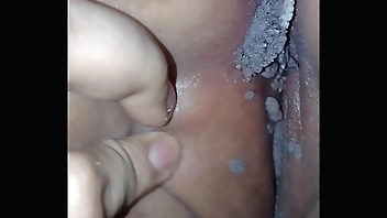 VPH VIRUS DEL PAPILOMA HUMANO ETS